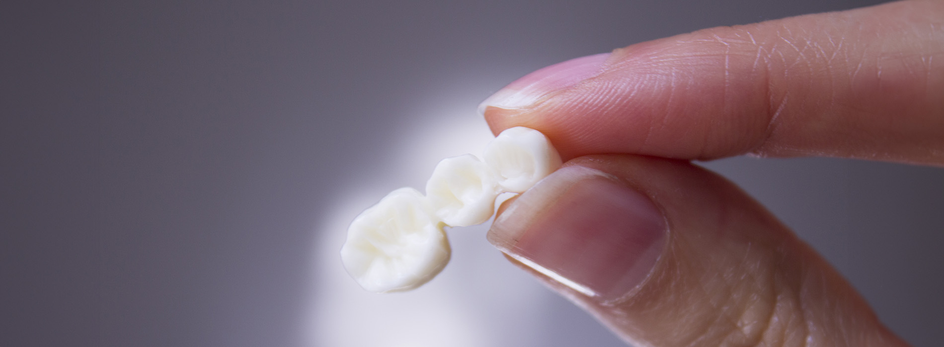 The image shows a close-up of a hand holding a small white object with a glossy texture, likely a dental implant or tooth replacement, against a plain background.